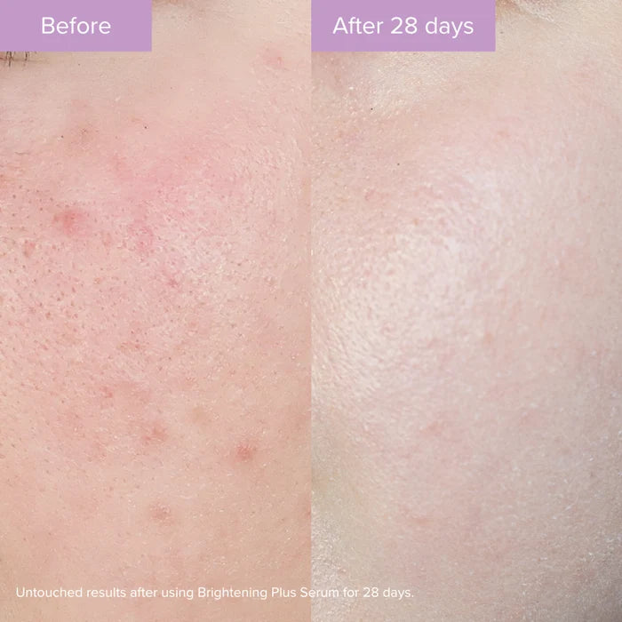 Brightening Plus Serum