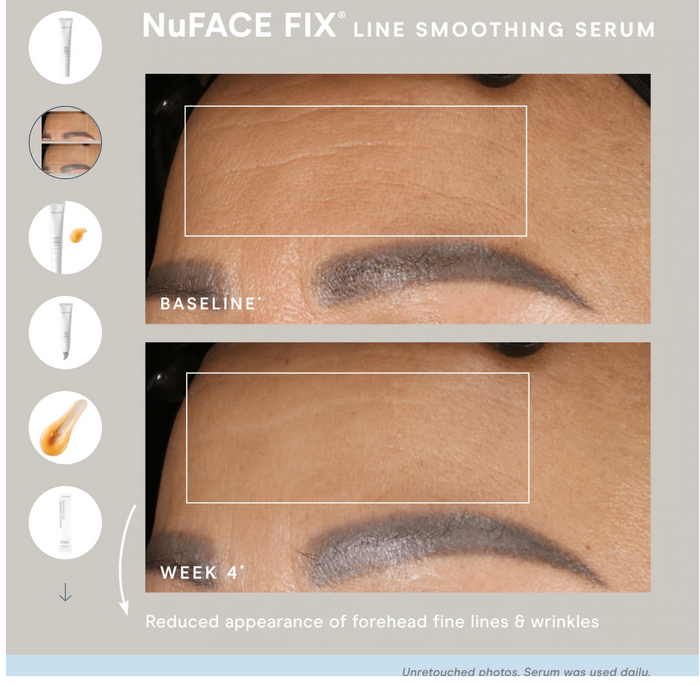 NuFACE FIX Line Smoothing Serum